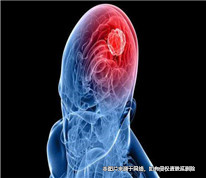 丈夫突發(fā)腦溢血，妻子撤回離婚訴訟