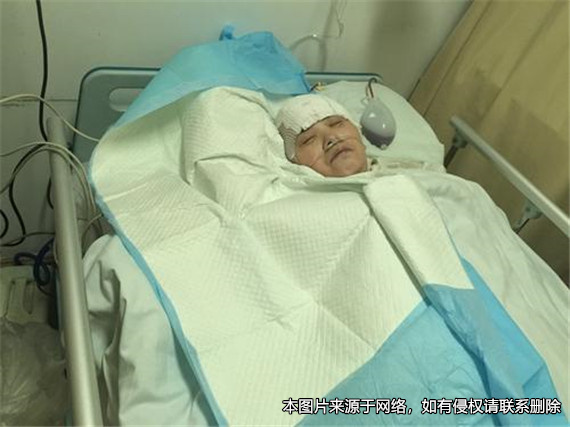女兒不對植物人父親盡撫養義務，被判不能完全繼承父親的遺產