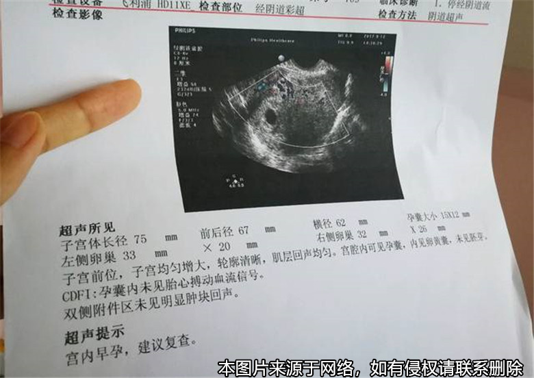 丈夫以妻子兩次擅自流產為由起訴離婚并索要賠償
