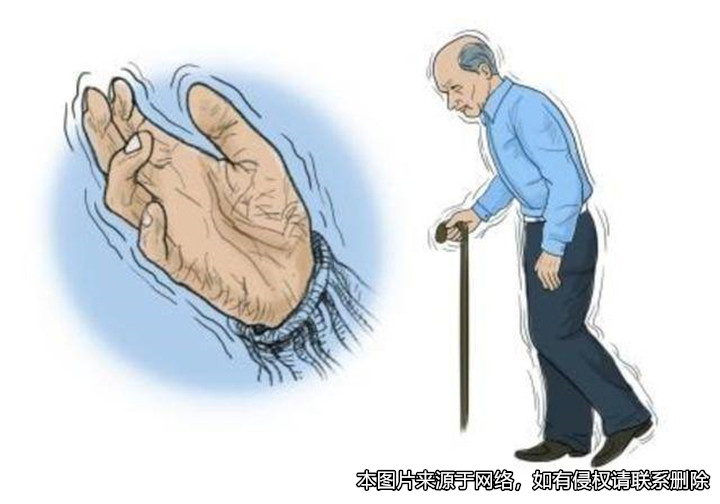 老人患帕金森綜合癥而讓人代書的遺囑，沒有親筆簽名是否有效？